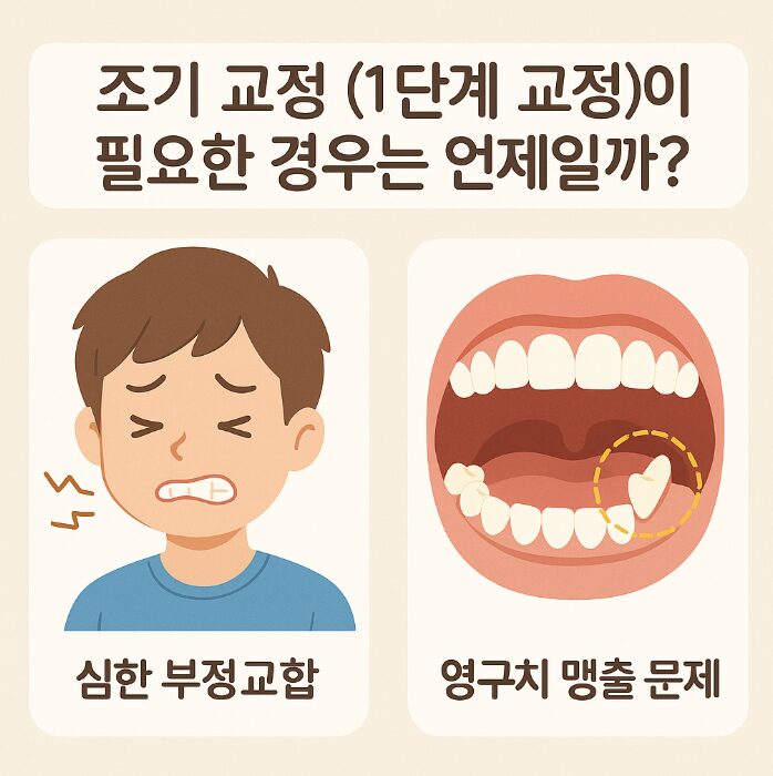 내 아이 치아교정, 언제 시작해야 할까? 시기별 교정 가이드 2 1차 교정