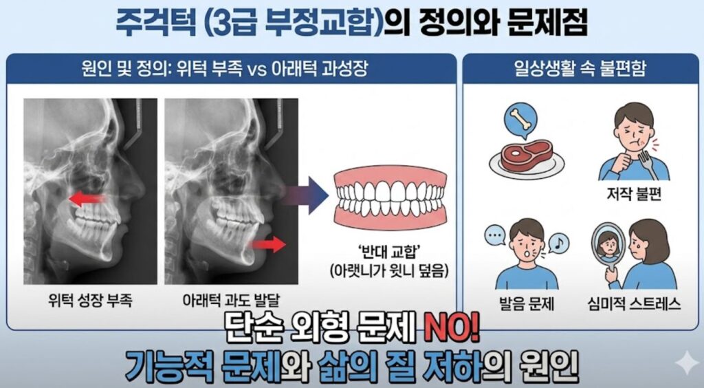 선릉역 치아교정: 주걱턱(3급 부정교합) 비수술·비발치 교정으로 되찾는 자신감 3 image 3